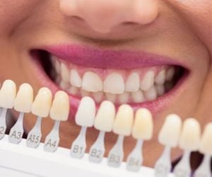 2d896538 Reabilitação oral com coroas de porcelana individuais
