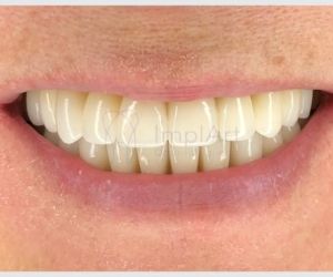 2fe51bf0 Tratamento dentário rápido em São Paulo