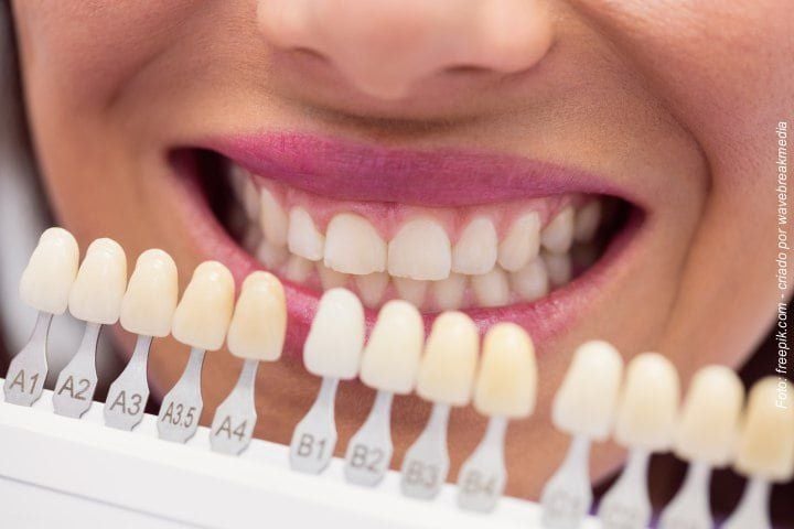 escolher_cor_dos_dentes_escala_50kb-38f1d992 Qual Cor dos Dentes é Ideal para Lentes e Coroas de Porcelana ?