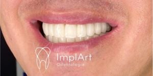 3de346d0 Calculadora online para anestesia odontológica