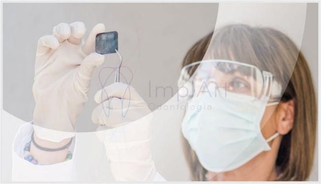 46e85ec0 Complicações / erros e falhas em implantes dentários