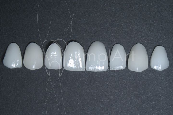 4dca39d4 Vídeo de lentes de contato para os dentes: o que são?