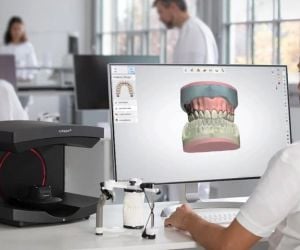 6794586f Rejeição de implante dentário: pode ocorrer?