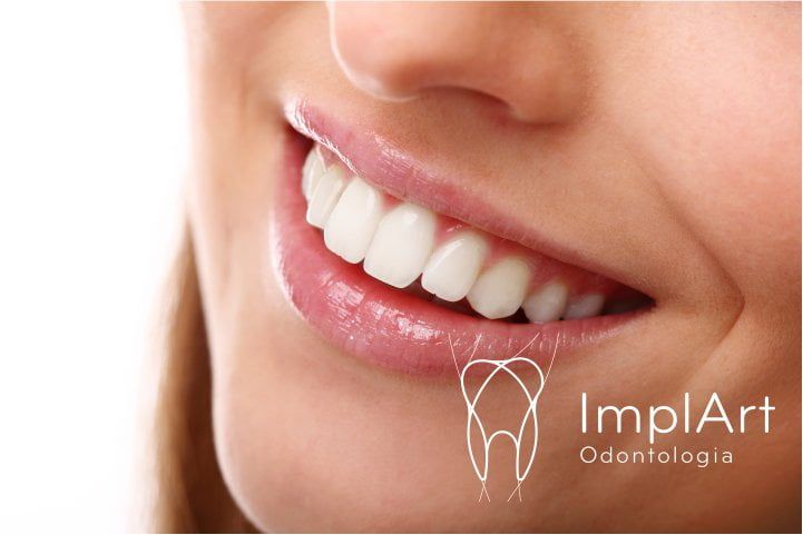 71f014d3 Sonhar Com Dente Caindo Ou Quebrado