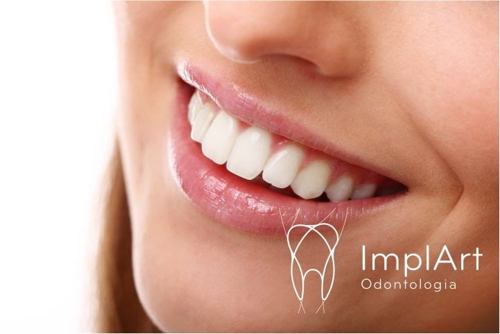 DAY-CLINIC-ODONTOLOGICO-EXPRESS-site-71f014d3 Sonhar Com Dente Caindo Ou Quebrado
