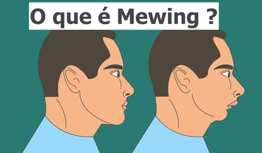8588147f O que é Mewing?