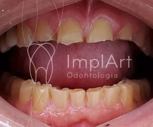 8eecea52 ImplArt - Spa odontológico - Clínica de implantes dentários e estética dental