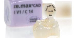 coroa_emax_49kb-9e952caa Quanto custa um implante com carga imediata