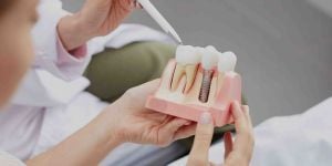 9fafa8a2 Seu dentista é especialista em Implantodontia / Implante Dentário ?