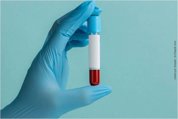 a2c0724b Enxerto ósseo com plasma rico em plaquetas - PRP