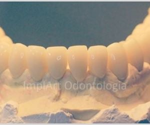 a6d16721 Estética Dental - Odontologia estética personalizada