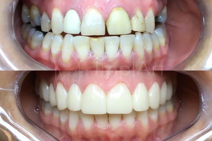a8e2af6b Estética Dental - Odontologia estética personalizada