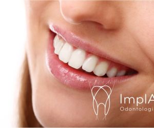 ad5cad33 ImplArt - Spa odontológico - Clínica de implantes dentários e estética dental