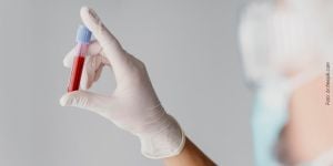 ae037144 Aparelho autoligado estético - vantagens