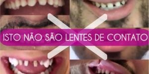 isso-nao-e-lente-site-b118a95b Desafios para os Implantes Dentários em Pacientes Diabéticos