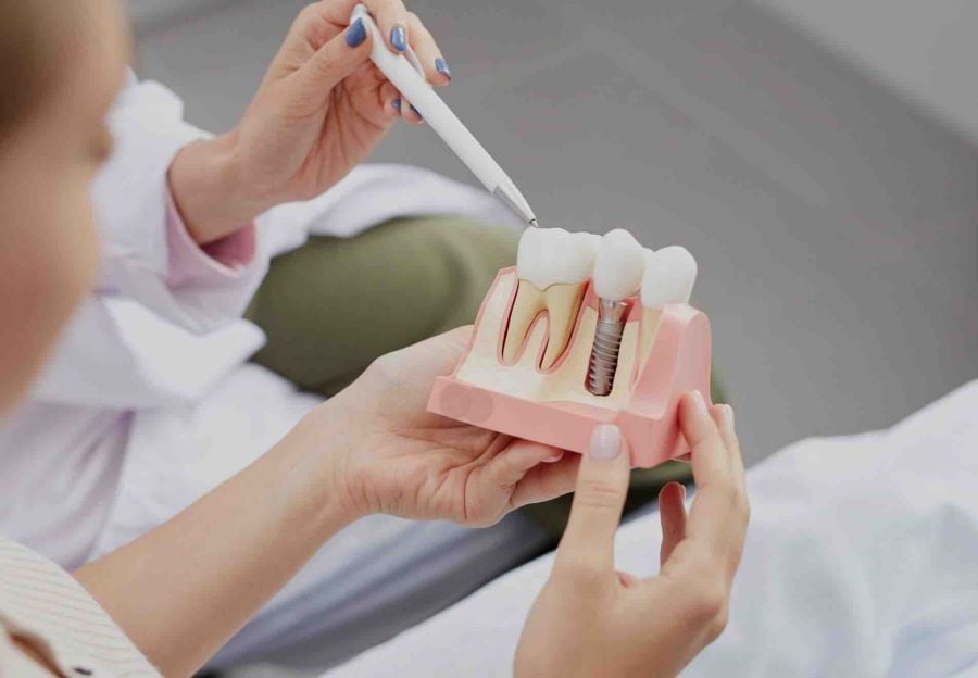 bc1d99b9 Devo fazer um implante dentário pelo plano ou de forma particular