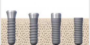 c7753b15 Tratamentos odontológicos clínicos sob sedação