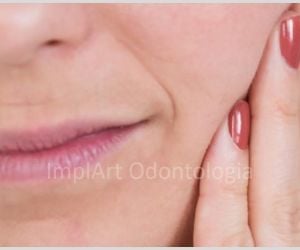 infeccoes_gengivais_30kb-c8de962e Rejeição de implante dentário: pode ocorrer?