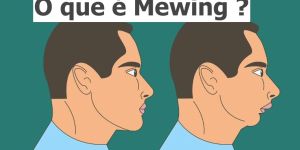 o-que-e-mewing-3-cb97943c Lábio leporino e implantes dentários para substituir dentes