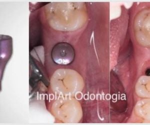 cd8b072b Sedação odontológica: tratamento dentário para odontofobia