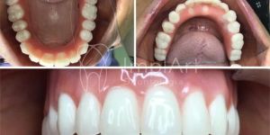 d14e9f96 Como saber se o Implantodontista é um bom profissional?