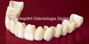 d274bdd5 Projeto de prótese dentária em 3D