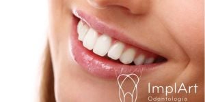 d6b9e9e7 Rejeição de implante dentário: pode ocorrer?