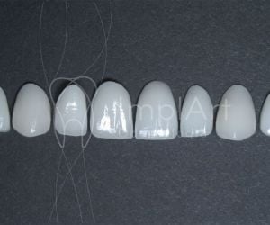 dc33454c O que fazer quando surge uma cárie dentária?