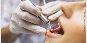 e8f18a7b Rejeição de implante dentário: pode ocorrer?