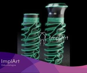 ede6b6b9 Carga imediata: qual a diferença para um tratamento normal