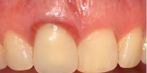f9f9b6be Seu dentista é especialista em Implantodontia / Implante Dentário ?