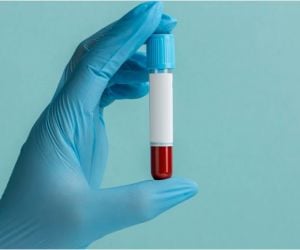 fa258ff6 Enxerto ósseo biomolecular para implante