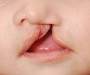 fe137d06 O que fazer quando surge uma cárie dentária?